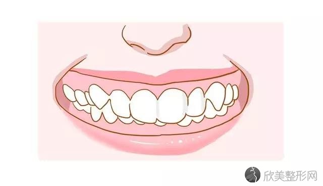 牙齿深覆合不进行矫正会有什么危害呢？