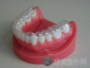 牙齿矫正的几个方法！