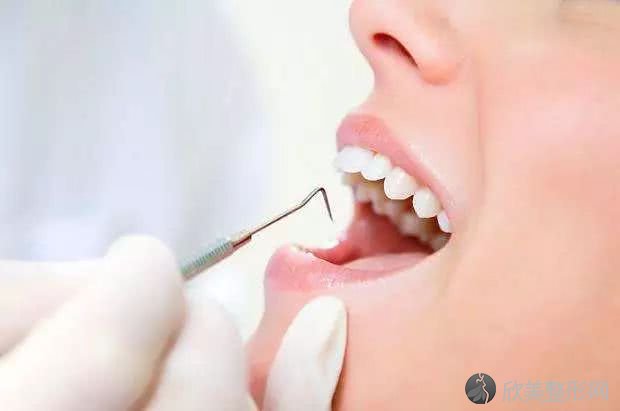“龅牙”是什么？通过矫正可以恢复吗？