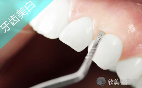 哪些小方法帮助你牙齿变白？