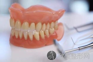 你知道假牙的种类吗？
