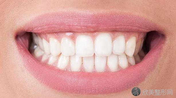 为什么会出现牙齿敏感？怎么才能快速缓解？
