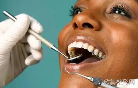 牙齿为何会敏感？