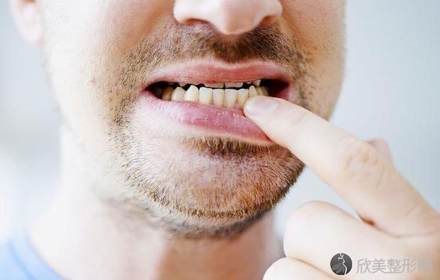 牙周炎需要注意什么？做好这4点，牙周炎不敢“靠近”来！