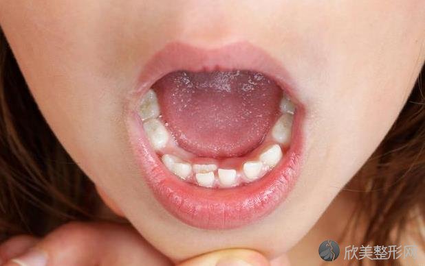牙齿出血怎么办？5个方法，或许能帮你缓解！