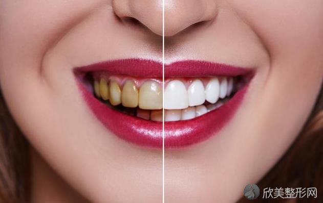 人的牙齿为什么会变黄？估计是没做好这6件小事！