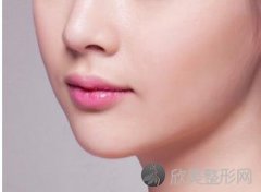 鼻唇沟填充价格多少？鼻唇沟填充用什么材质好