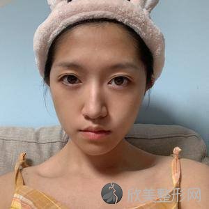 成都华西医院肖海涛怎么样?自体脂肪面部填充地址-特色项目-整形价格表