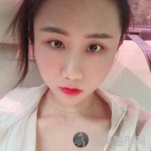 成都米兰柏羽卢尚兵怎么样?自体脂肪面部填充顾客反馈案例-收费标准
