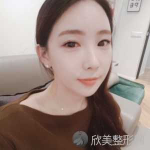 成都艺星整形医院胡国华怎么样?玻尿酸面部填充附案例及价格表