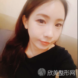 成都艺星整形医院胡国华怎么样?玻尿酸面部填充附案例及价格表