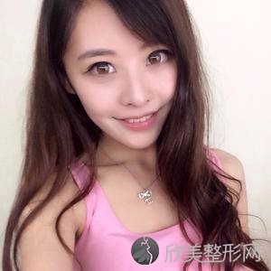 佛山美莱刘昕医生怎么样?自体脂肪面部填充顾客术后反馈案例-收费标准
