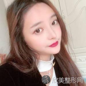 广州广大医院柳超做颧骨咋样?吸脂瘦脸案例和价格同步分享！