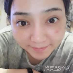 广西哪家医院做吸脂去副乳手术较好？排行榜德亚、老贵族男士整容、梧州人民