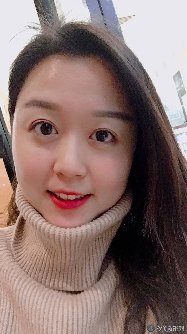 淮南东方医院集团谢一医院朱传国做面部吸脂怎么样？附医生简介-面部吸脂案