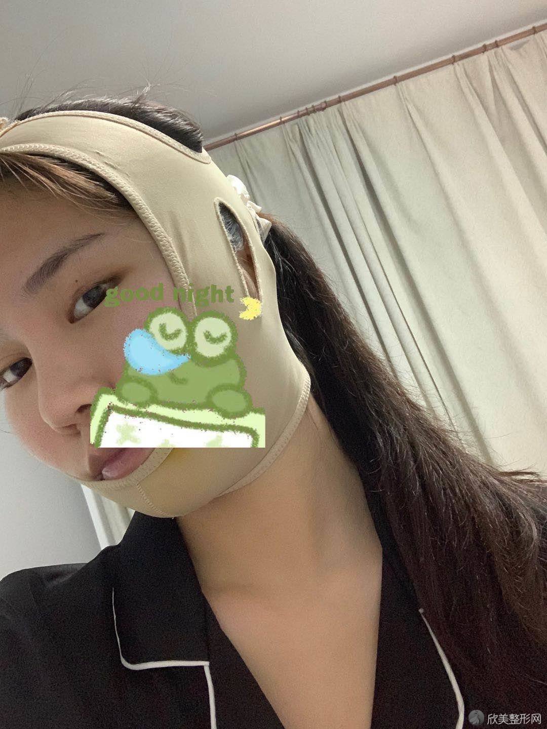 海南哪家医院做颌面整形手术较好？排行前三不仅看医院实力！