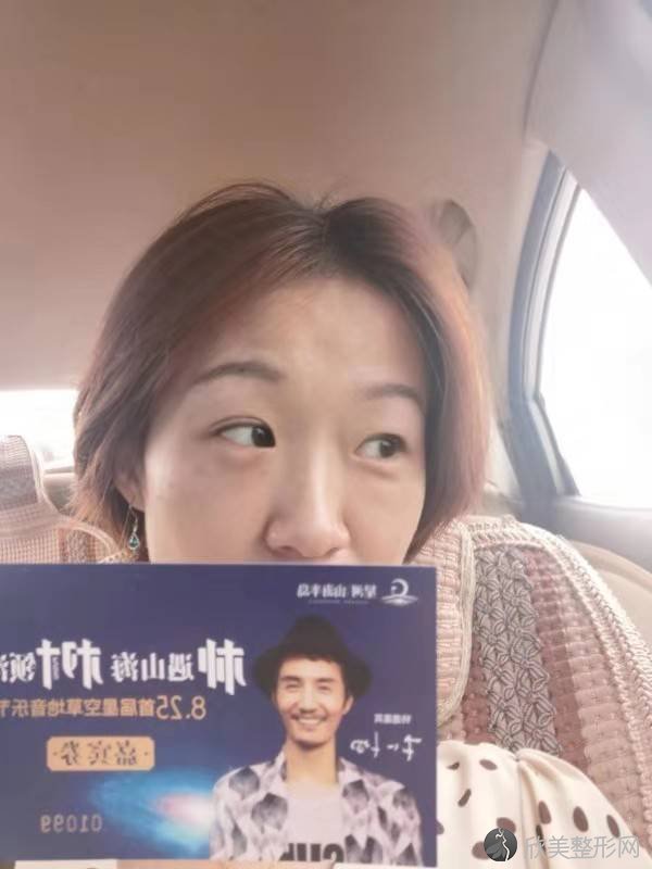 河南哪家医院做激光去眼袋靠谱？当属臻美、科技大学、妇幼保健院这三家!价