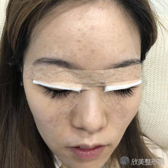 梧州哪家医院做眼综合比较好？排名前五医院评点-附手术价格查询！