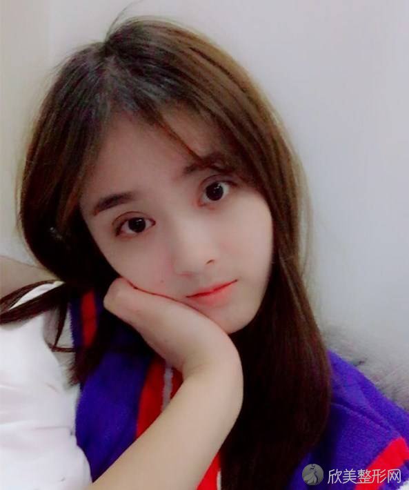 淮北时光医疗美容门诊部刘慧做开眼角怎么样？附医生简介-开眼角案例及价格