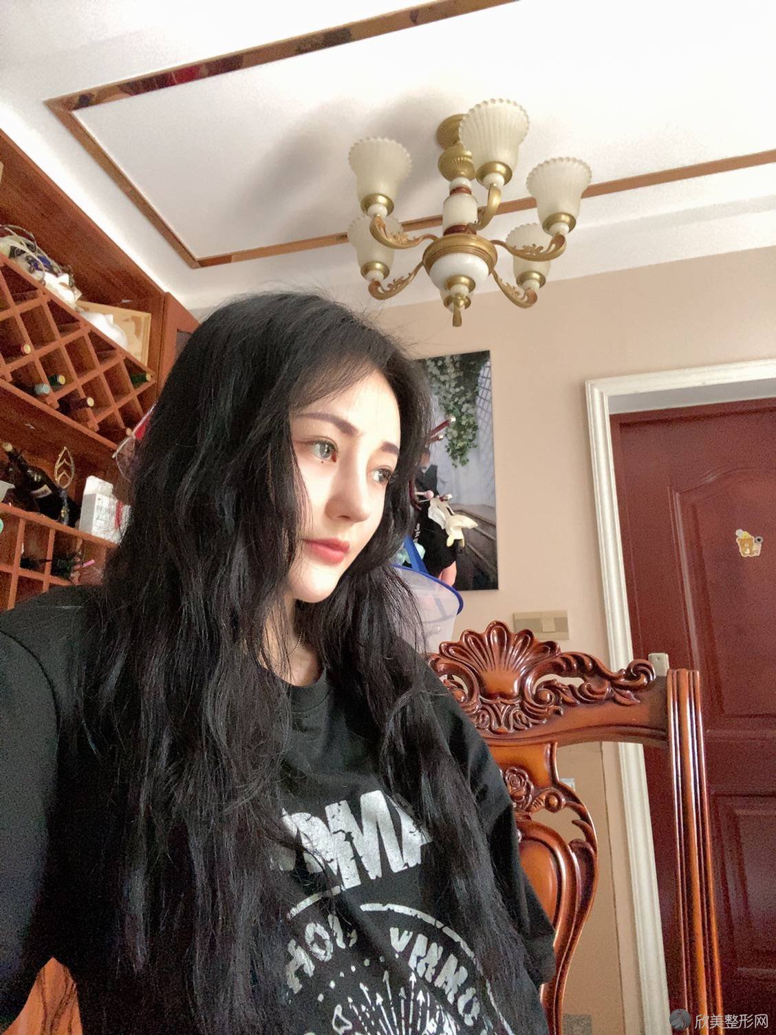 黔西南哪家医院做鼻小柱延长比较靠谱？正规排名榜盘点前四-价格清单一一出