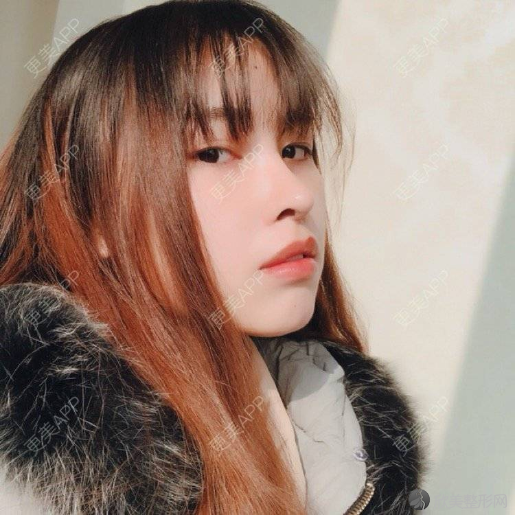 黔西南哪家医院做鼻小柱延长比较靠谱？正规排名榜盘点前四-价格清单一一出