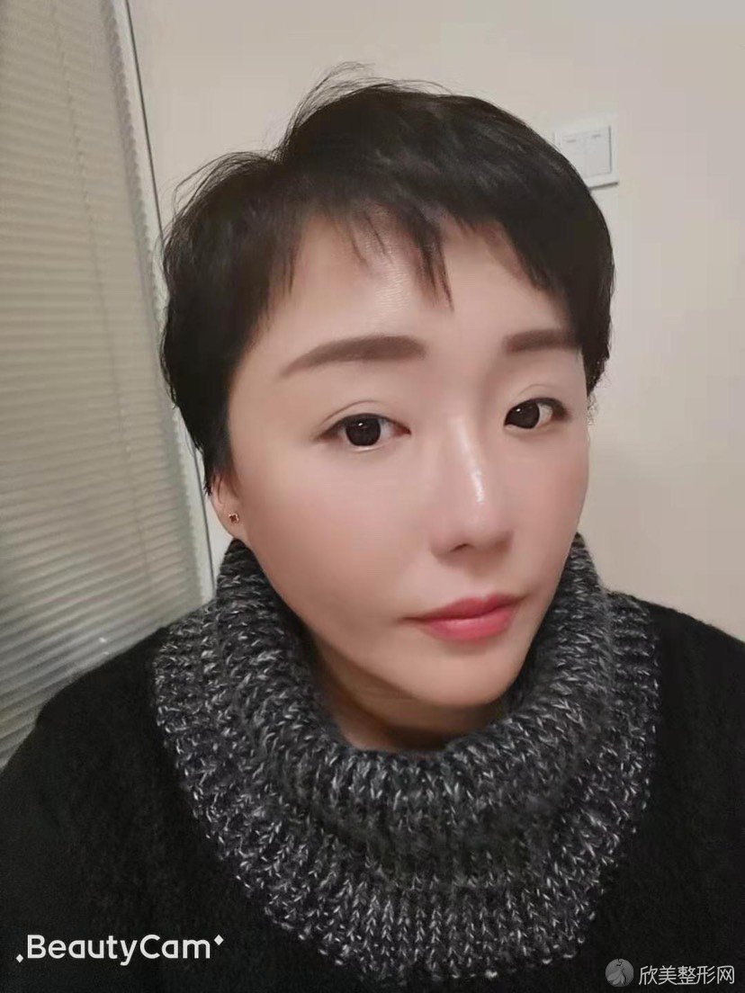 汉中哪家医院做下巴吸脂术较好？排行榜医院齐聚-谭医生、南京医科大学附属