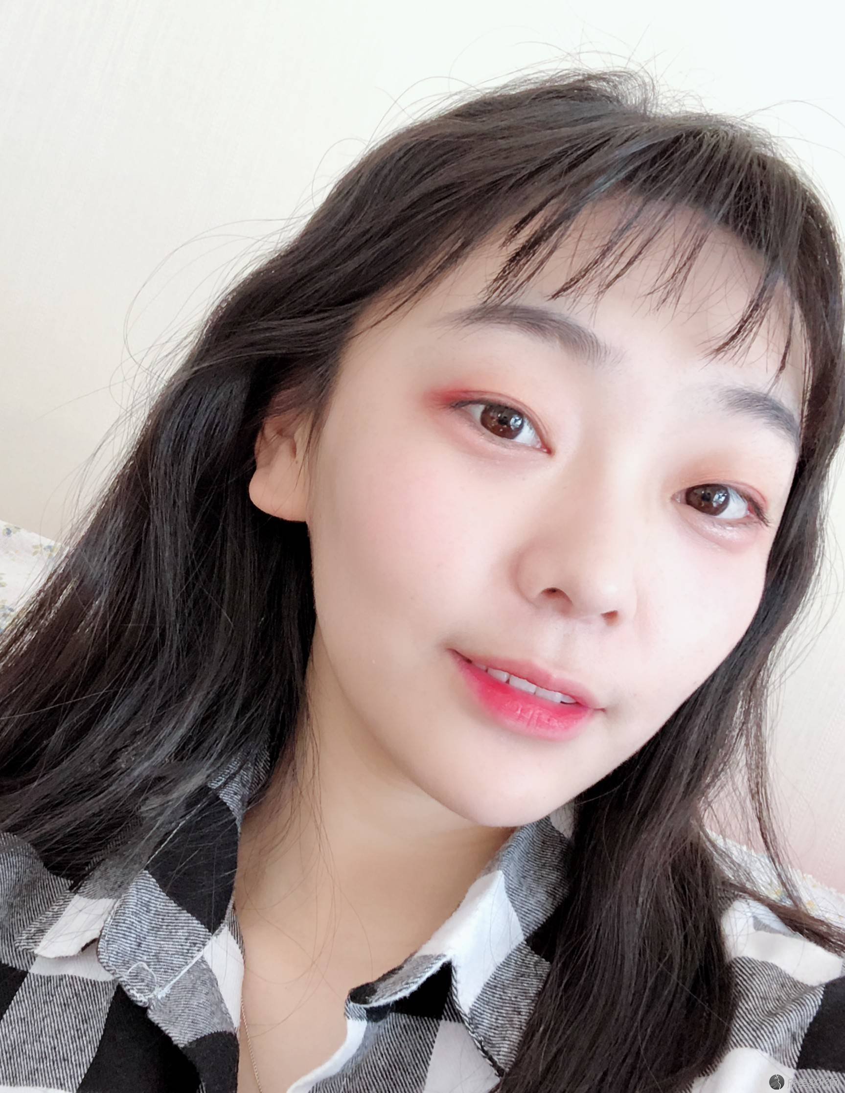长春美奇国际医疗美容医院张鹏飞做面部年轻化手术怎么样？附医生简介-面部
