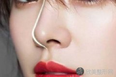 上海自体脂肪隆鼻效果好吗