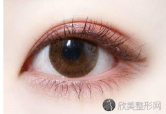 杭州双眼皮修复术要注意什么？