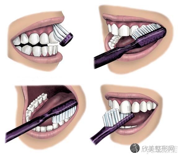 Dental_BrushingTeeth.jpg