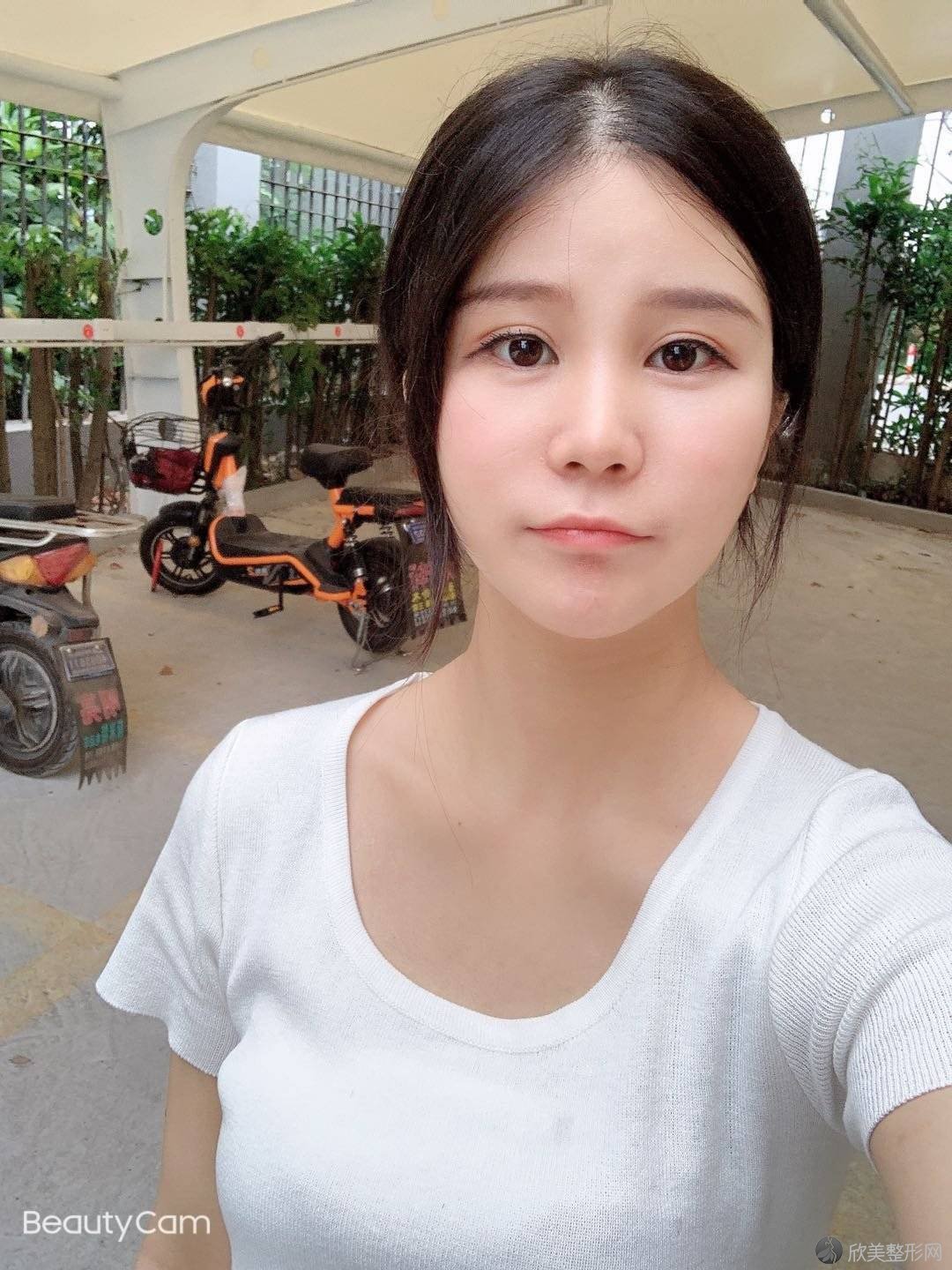 娄底哪家医院做下颌角整形术效果好？排名前五口碑医院盘点-双峰县烧伤治疗