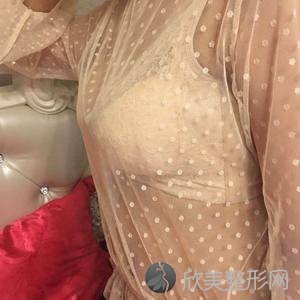 嘉峪关哪家医院做假体丰胸手术好？正规排名榜盘点前四-价格清单一一出示!！