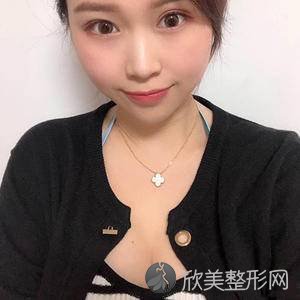 嘉峪关哪家医院做假体丰胸手术好？正规排名榜盘点前四-价格清单一一出示!！