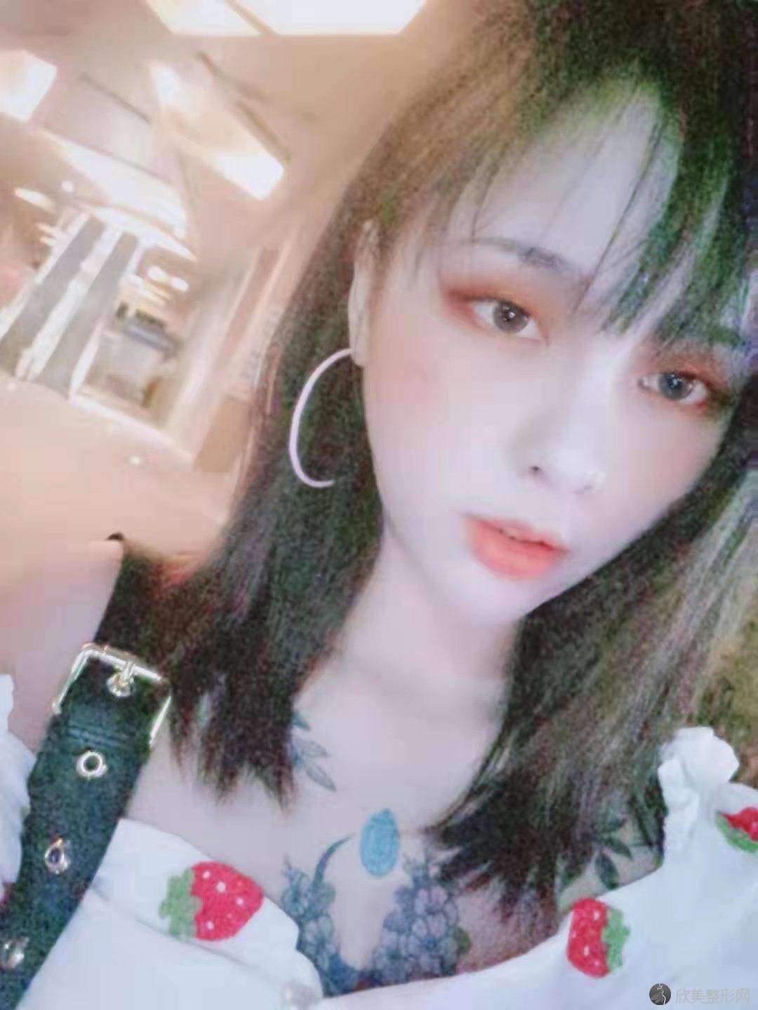 朝阳哪家医院做开外眼角比较靠谱？思美丽妍国际、京美、一美等实力在线比较