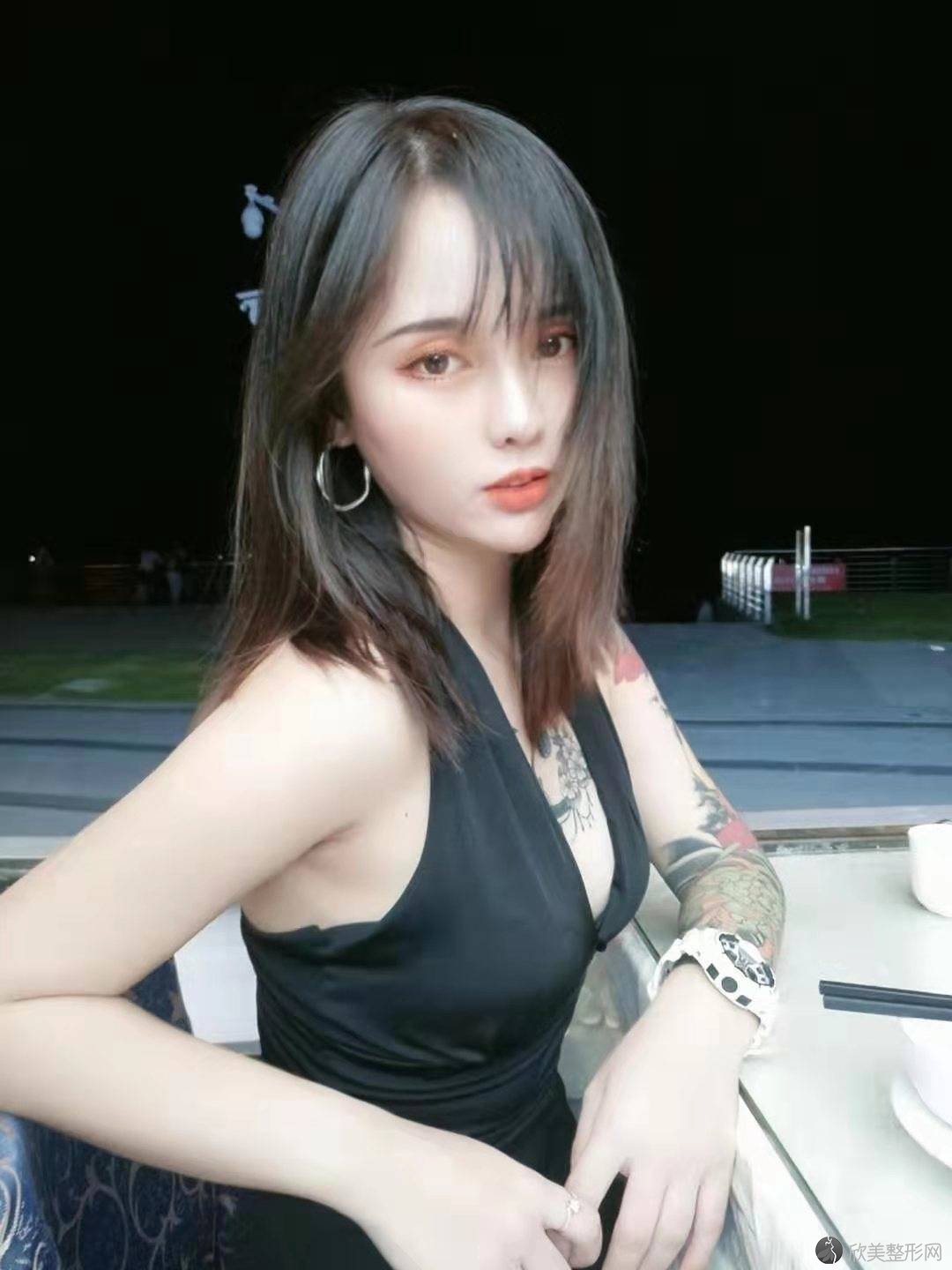 朝阳哪家医院做开外眼角比较靠谱？思美丽妍国际、京美、一美等实力在线比较