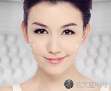 杭州做丰下巴费用是多少
