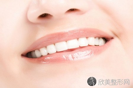 郑州牙齿美白有哪些方法