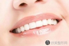 冷光美白牙齿效果怎么样