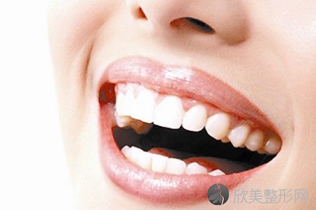 重庆做冷光牙齿美白整形有副作用吗