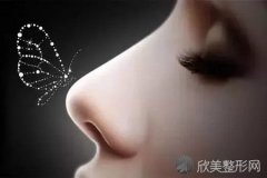 同样是隆鼻，为什么别人美翻天你却丑cry