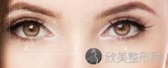 苏州哪家医院做双眼皮好