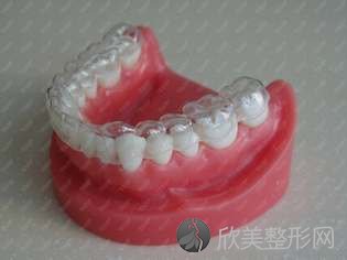 用隐形正畸材料做牙齿矫正的过程有哪些