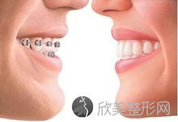 上海做牙齿矫正去哪里治疗效果好