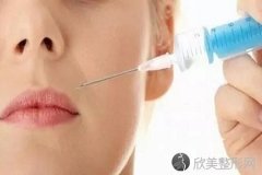 上海打水光针会反弹吗