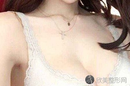 上海做假体隆胸术后注意事项有哪些