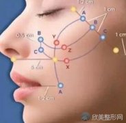 上海做埋线提升要多长时间才能恢复