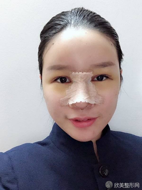 蚌埠康美整形美容医院金熙大做自体脂肪面部填充怎么样？附医生简介-自体脂