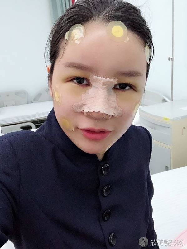 蚌埠康美整形美容医院金熙大做自体脂肪面部填充怎么样？附医生简介-自体脂