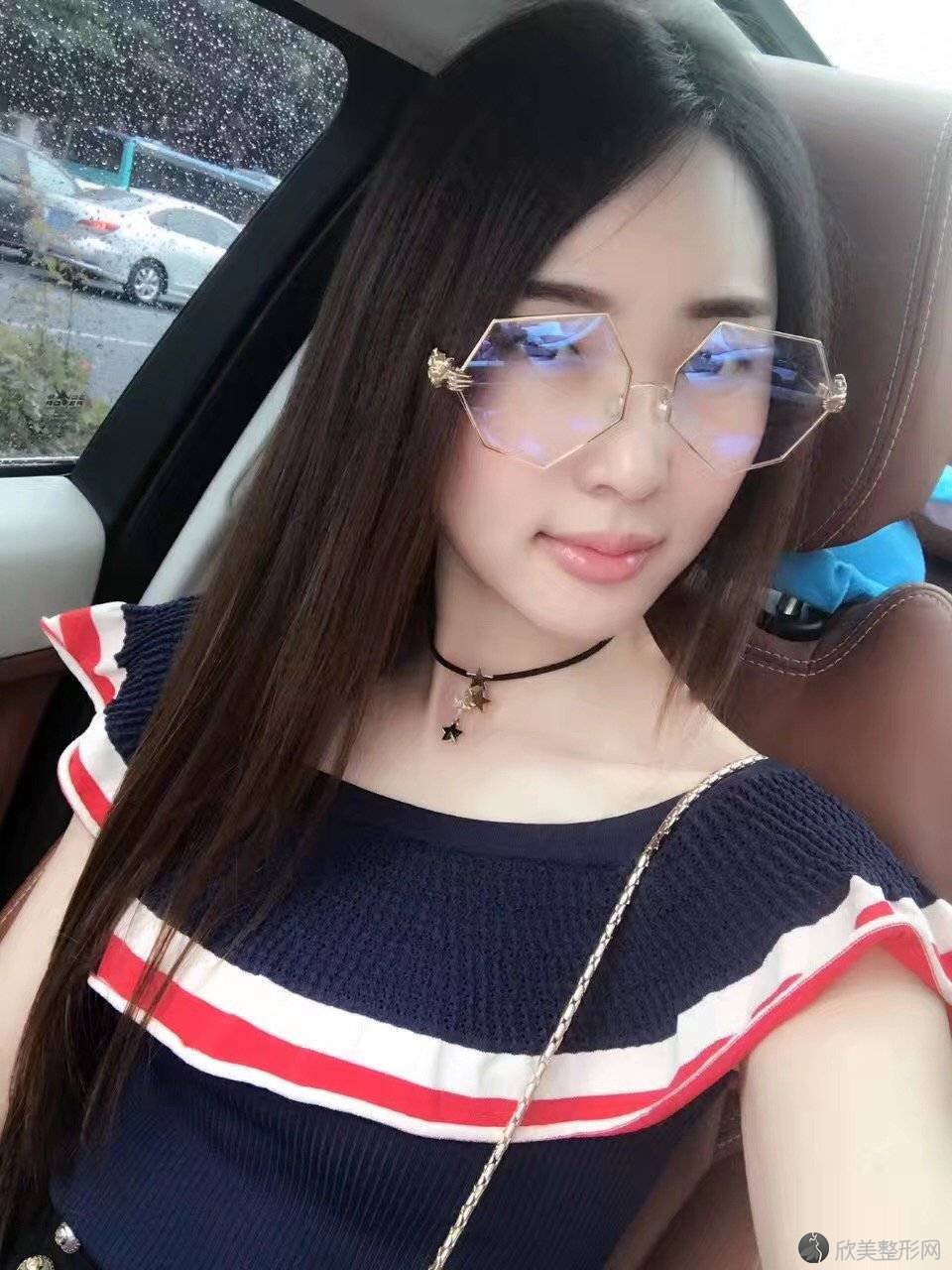 天津美联致美医学美容医院麻豫航做脂肪填充面部怎么样？附医生简介-脂肪填