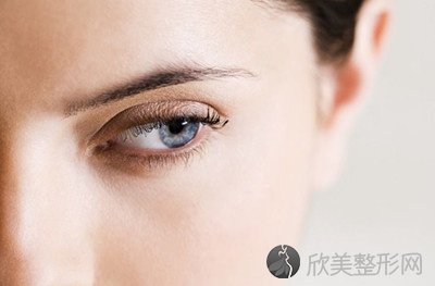 双眼皮埋线多少钱